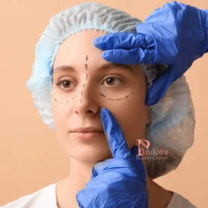 blepharoplasty